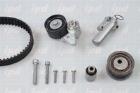 Timing Belt Kit IPD 20-1353